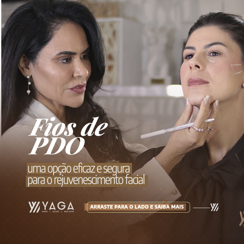 Fios de PDO uma opção eficaz e segura para o rejuvenescimento facial